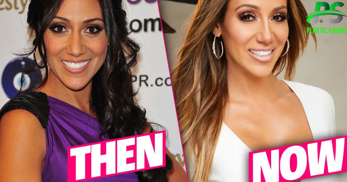 Melissa Gorga Before Plastic Surgery