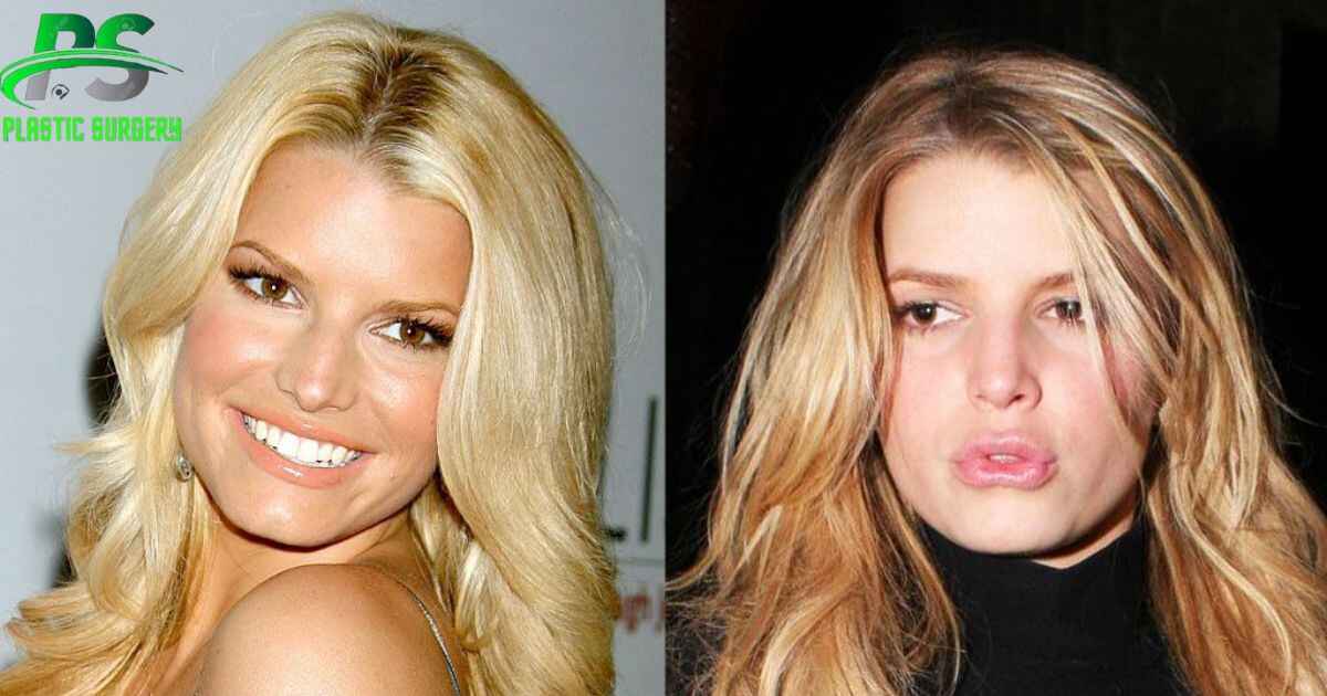 Smart Plastic Surgery Photos