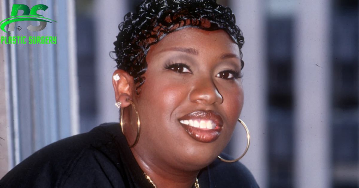 Missy Elliott Plastic Surgery