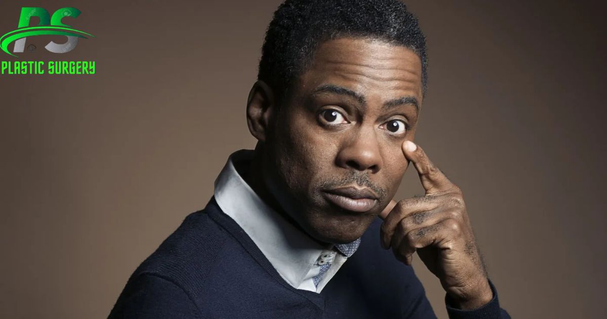 Did Chris Rock Have Plastic Surgery