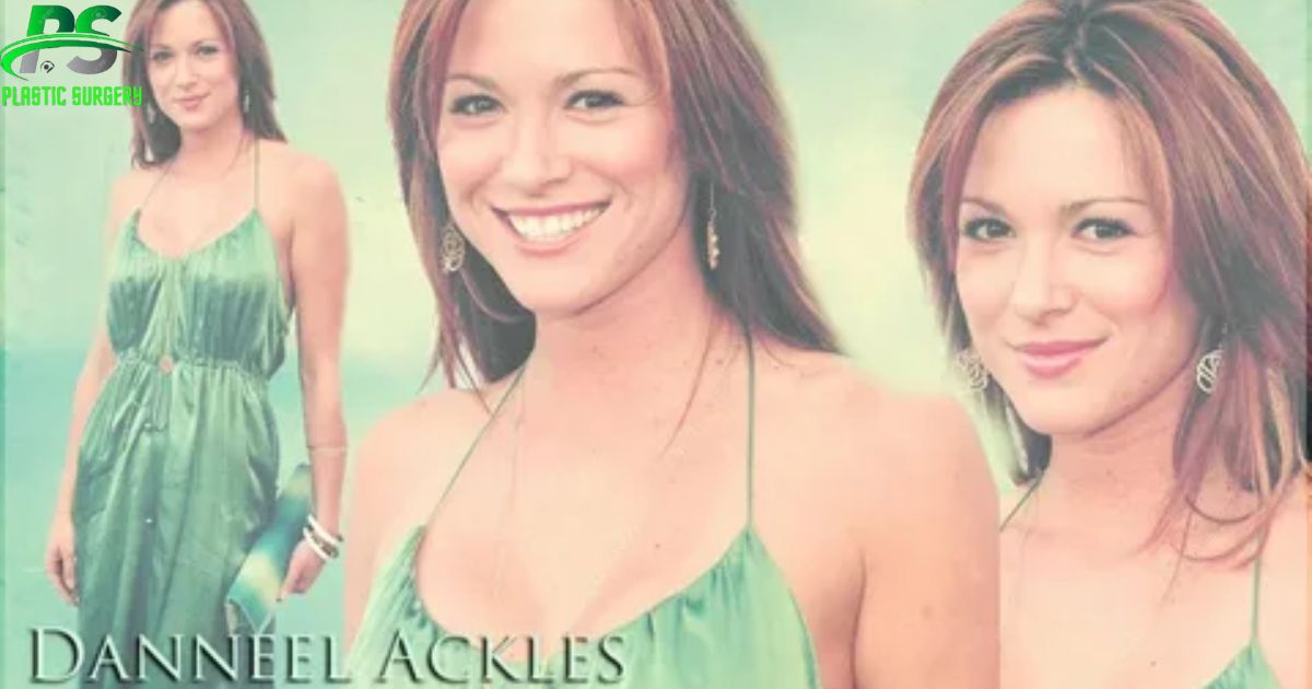 Danneel Ackles Plastic Surgery in 2024