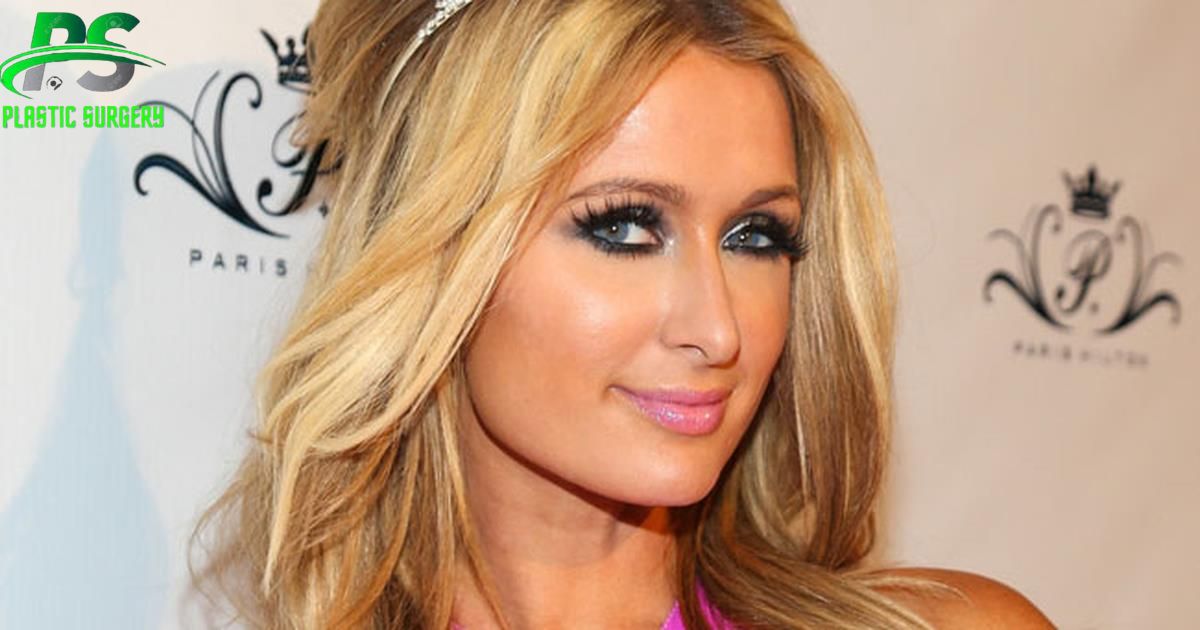 Paris Hilton Before and After Plastic Surgery