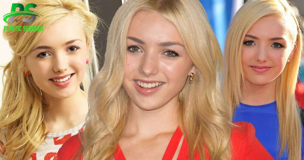 Has Peyton List Had Plastic Surgery?