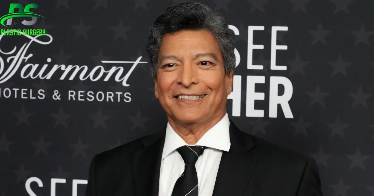 Gil Birmingham Plastic Surgery In 2024