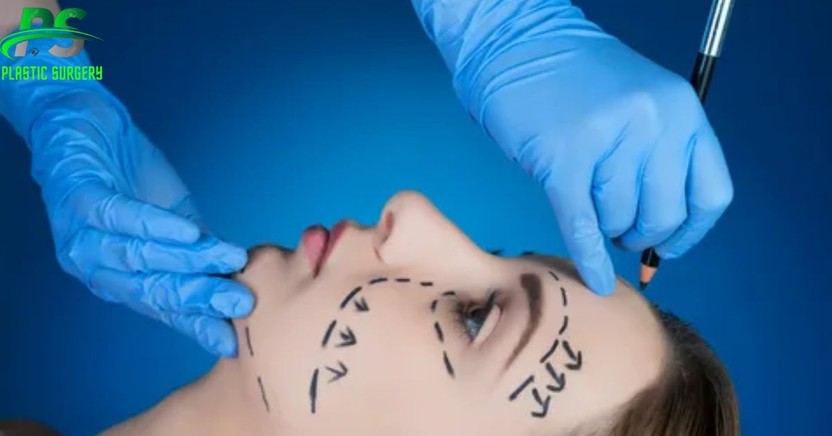 Plastic Surgery Lead Generation