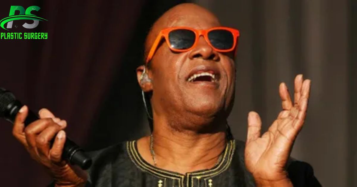 Stevie Wonder Plastic Surgery In 2024