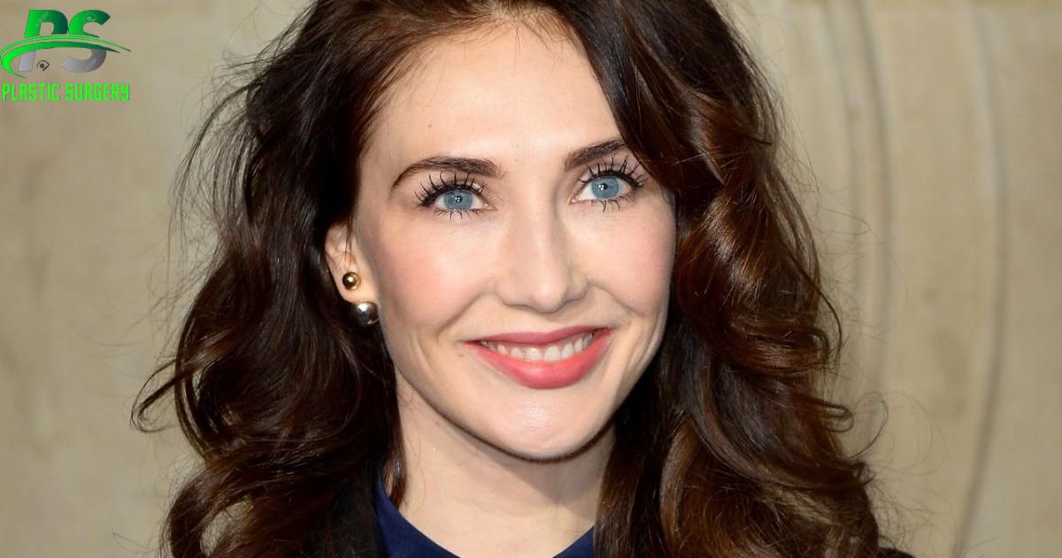 Carice Van Houten Plastic Surgery