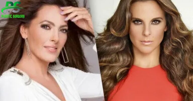 Kate Del Castillo Plastic Surgery