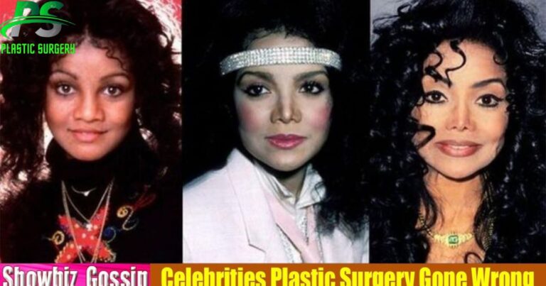 Latoya Surgery oya Jackson Before Plastic