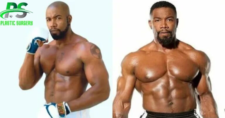 Michael Jai White Plastic Surgery